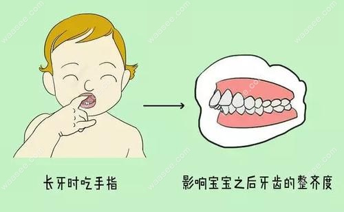 儿童骨性龅牙最佳矫正时间(图1)