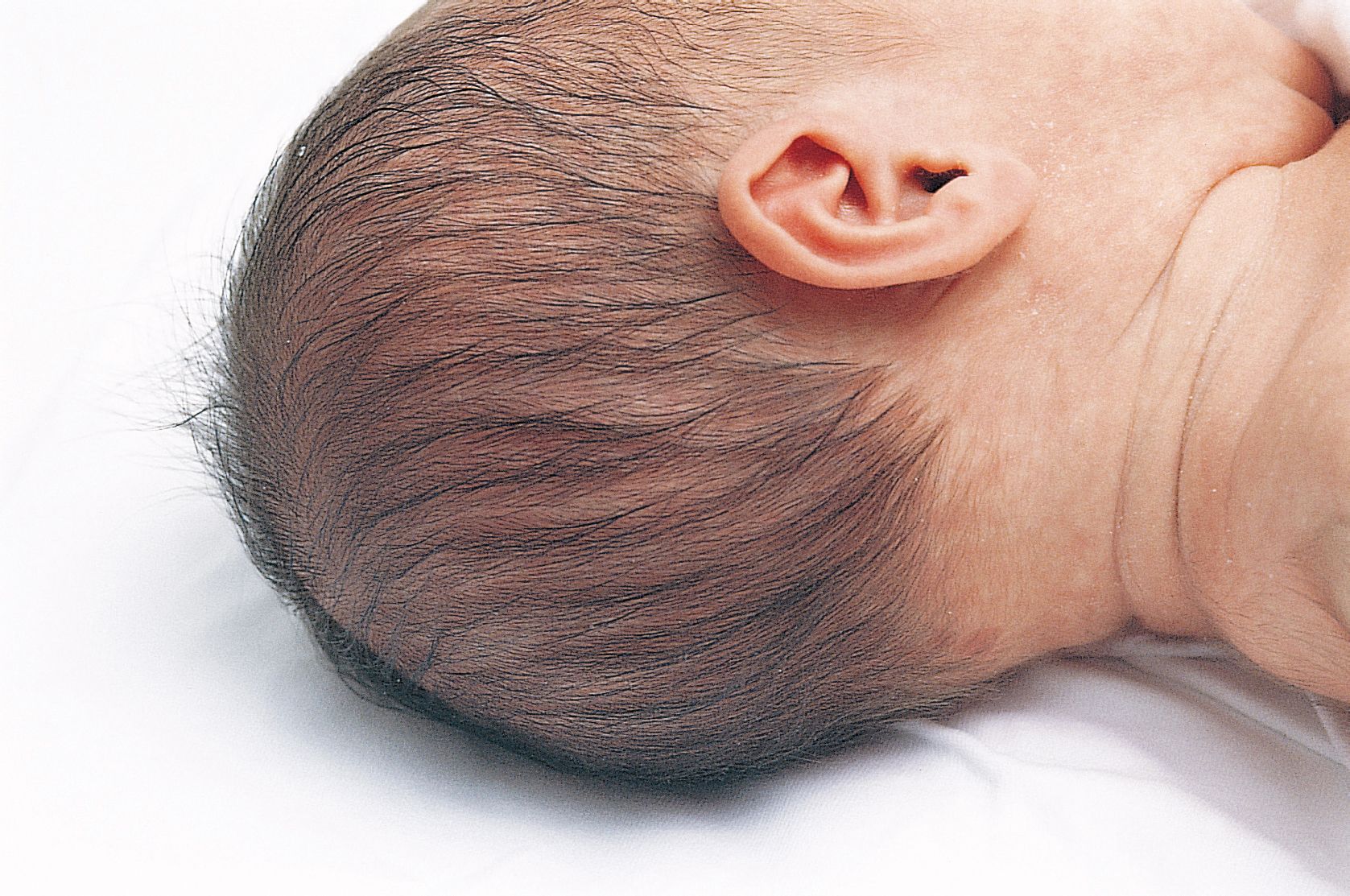 10个月～1岁的婴儿的头部发育