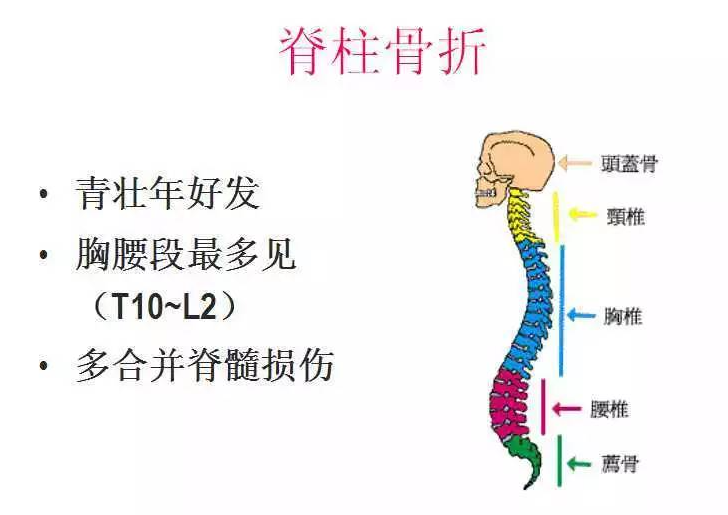 脊柱骨折的治疗方法和预防措施